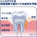 シュミテクト高濃度フッ素配合 <1450ppm> シュミテクト歯周病ケア