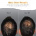 Viviscal Man Hair Growth Program / Добавка для роста и  укрепления мужских волос, 60 таблеток