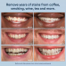 AuraGlow Teeth Whitening Gel, 44% Carbamide peroxide, 3x5ml Syringes